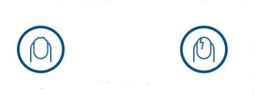 Déformation des ongles due à une infection fongique